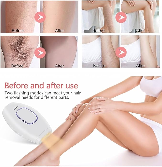 IPL Laser Hair Removal Device for Home Use – 999,999 Flashes