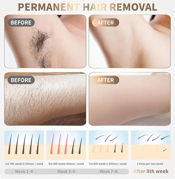 IPL Laser Hair Removal Device for Home Use – 999,999 Flashes